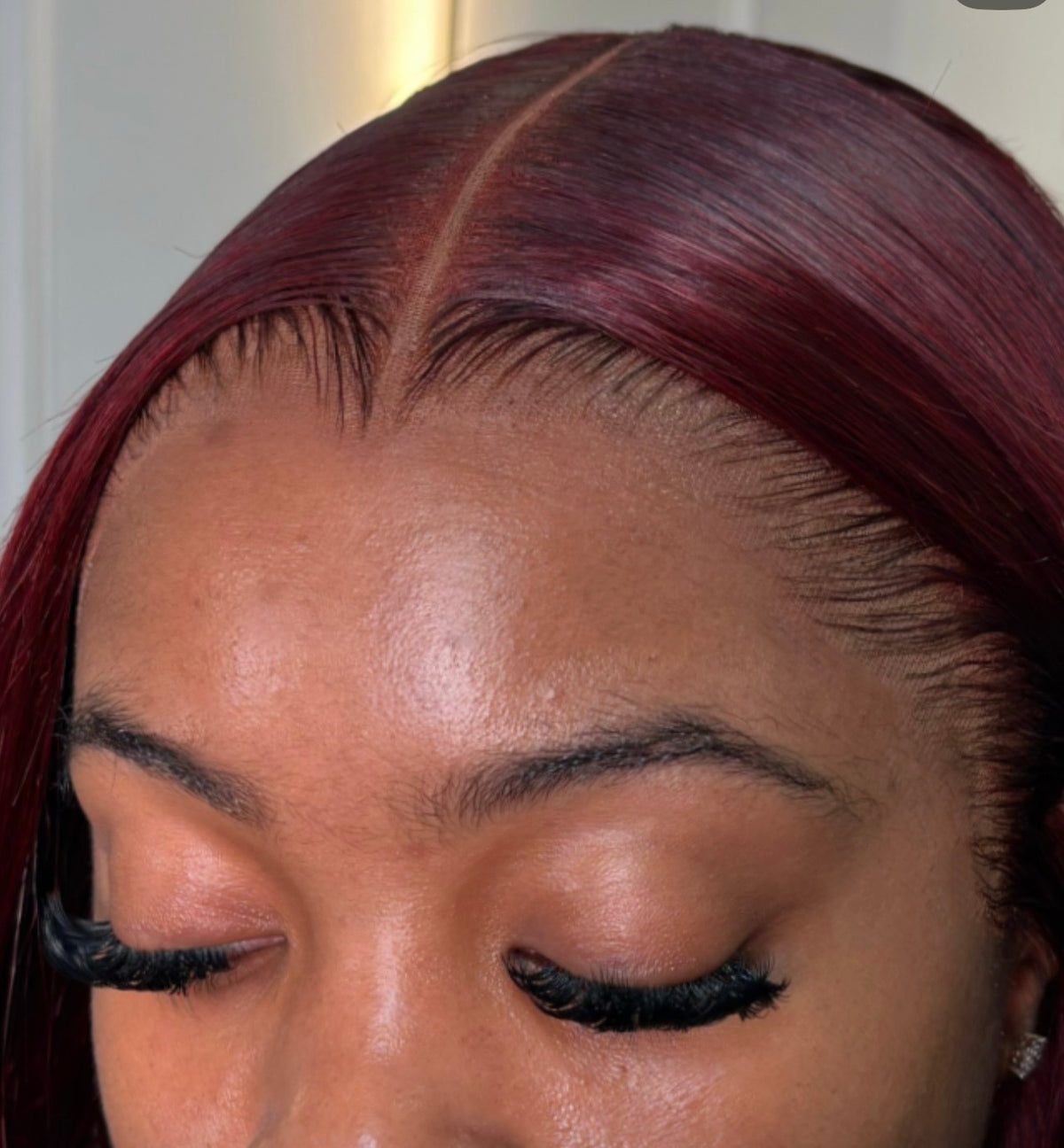HD Frontals